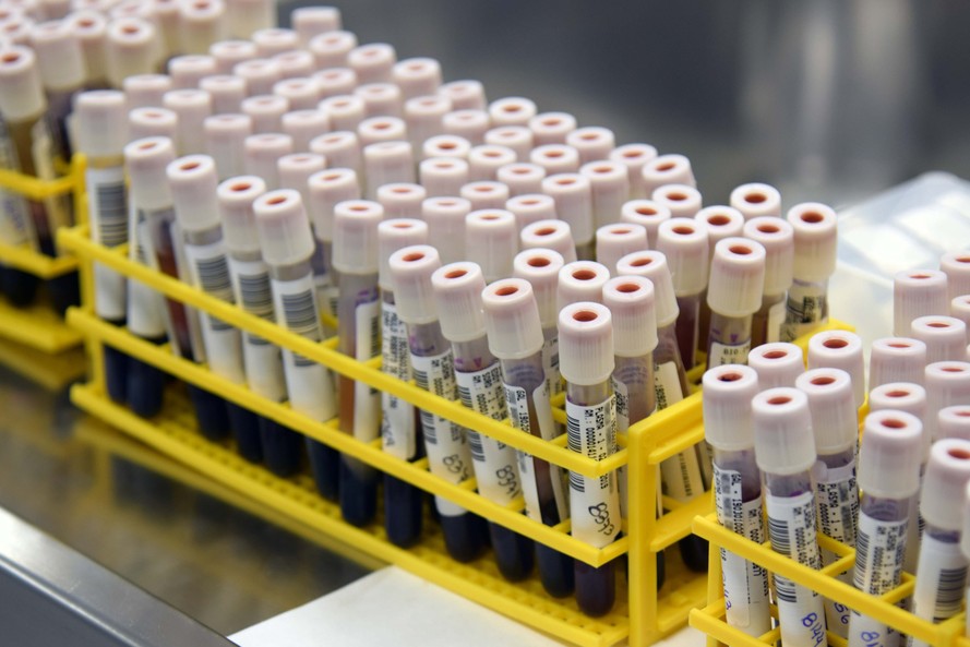Saúde orienta sobre diagnóstico diferencial da dengue e Covid-19 Cascavel