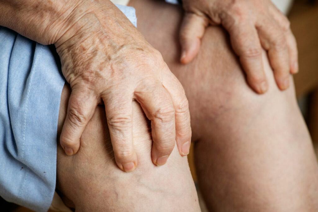 Como prevenir lesões nos joelhos e manter a independência na terceira idade 3 Como prevenir lesões nos joelhos e manter a independência na terceira idade