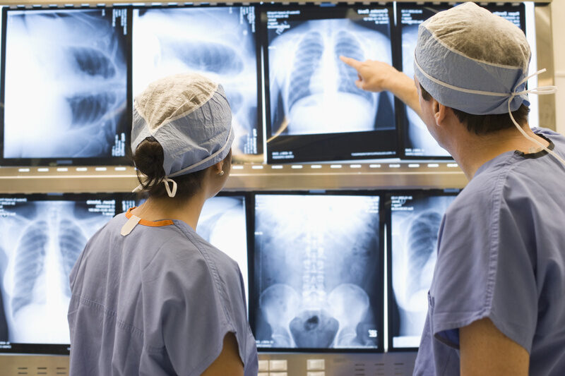 Agosto Branco: diagnóstico precoce e cirurgia minimamente invasiva transformam o tratamento do câncer de pulmã