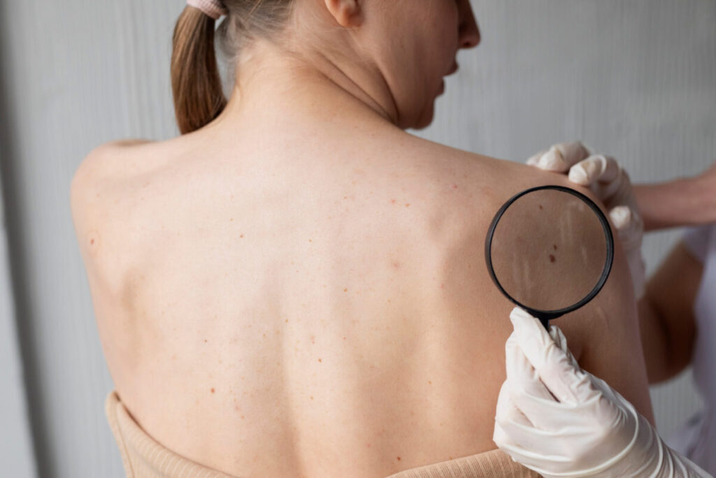 Pele também pede check-up: sinais de dermatite, urticária e psoríase não devem ser ignorados